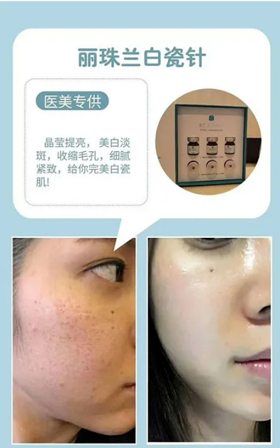 Rejuran Tone-up Booster 丽珠兰白瓷针 : -4
