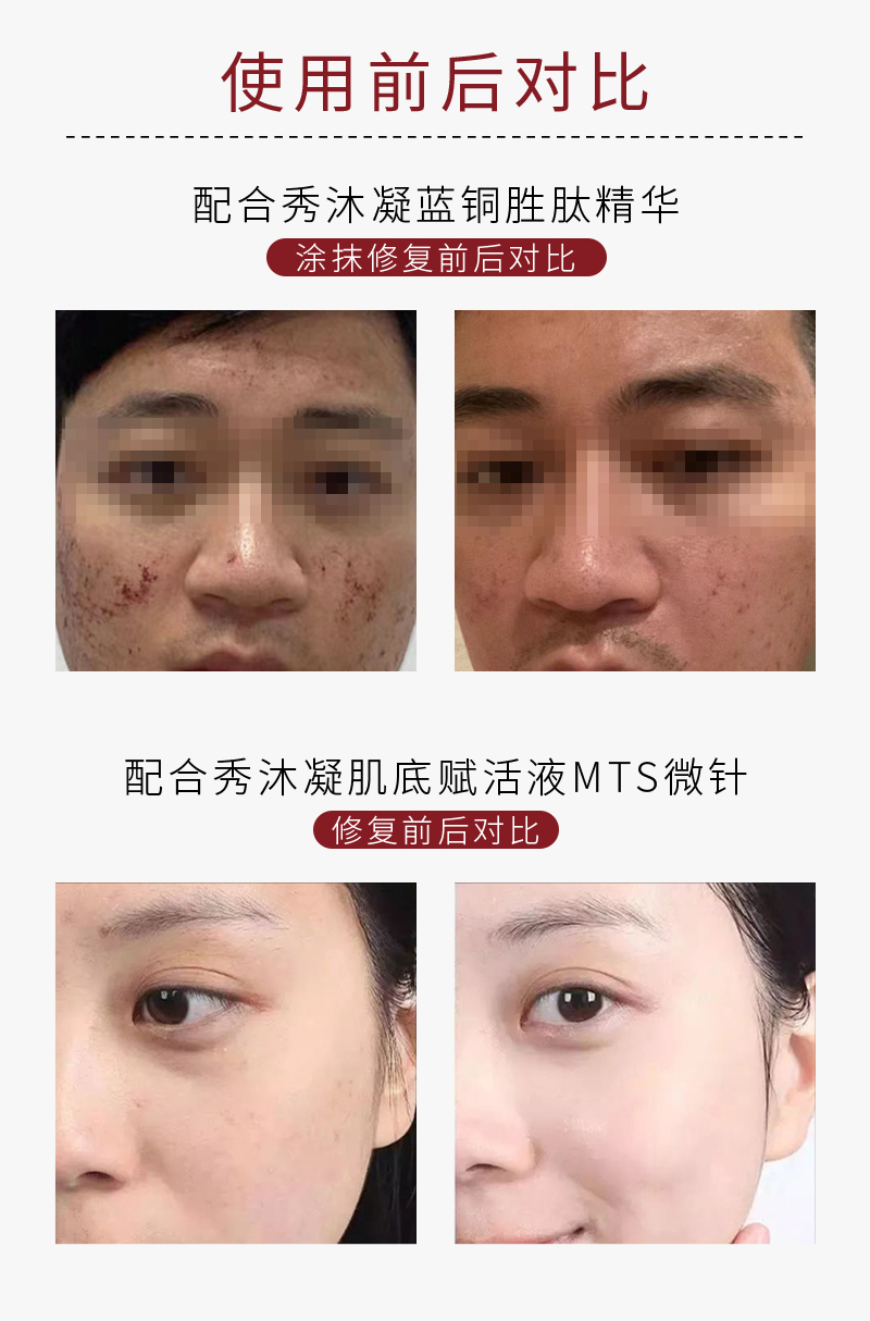 Therapeel 秀沐凝 冻干粉 : -6