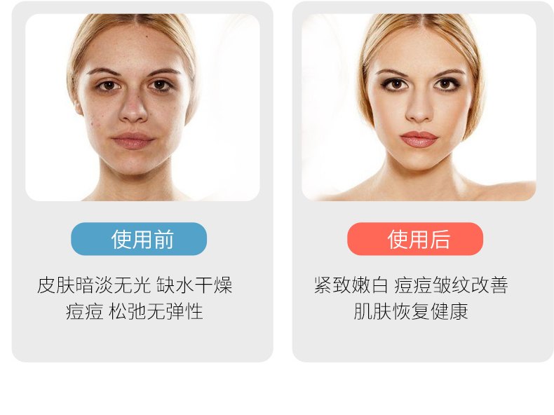 Cell Activation Instrument-Guangzhou Muning Biotechnology Co., Ltd.